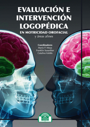 EVALUACION E INTERVENCION LOGOPEDICA EN MOTRICIDAD OROFACIAL Y AREAS AFINES